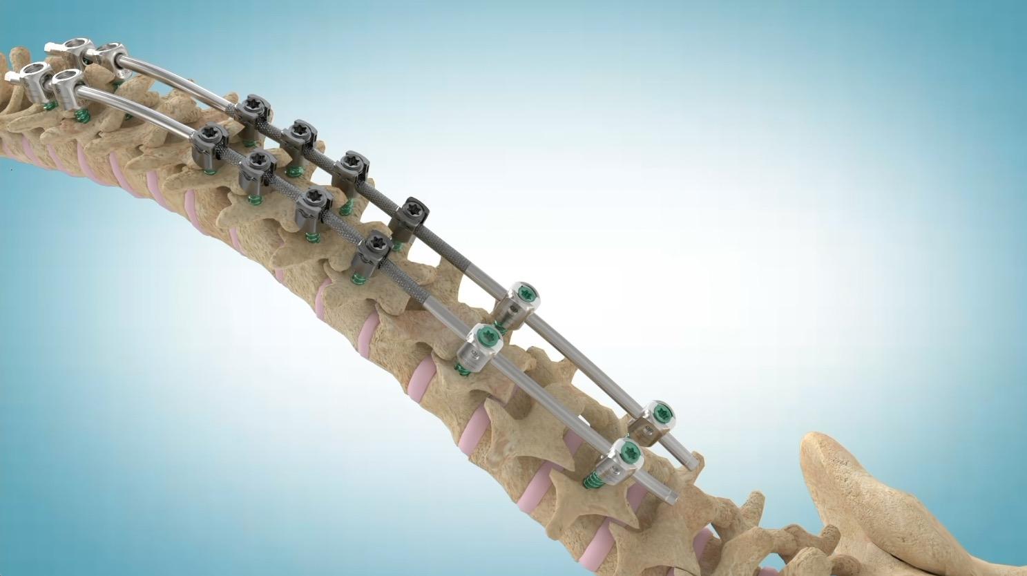 Why 3D Medical Animation Is One of the Most Powerful Tools for Explaining Complex Products