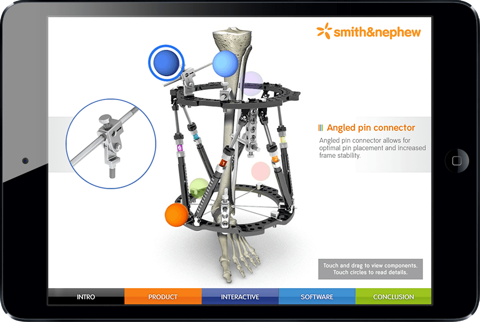Smith & Nephew TSF