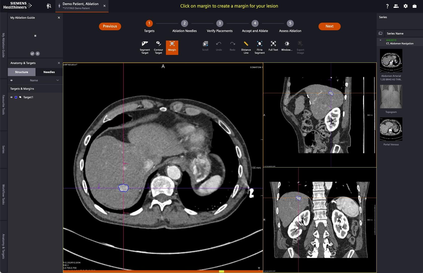 Siemens Healthineers My Ablation Guide