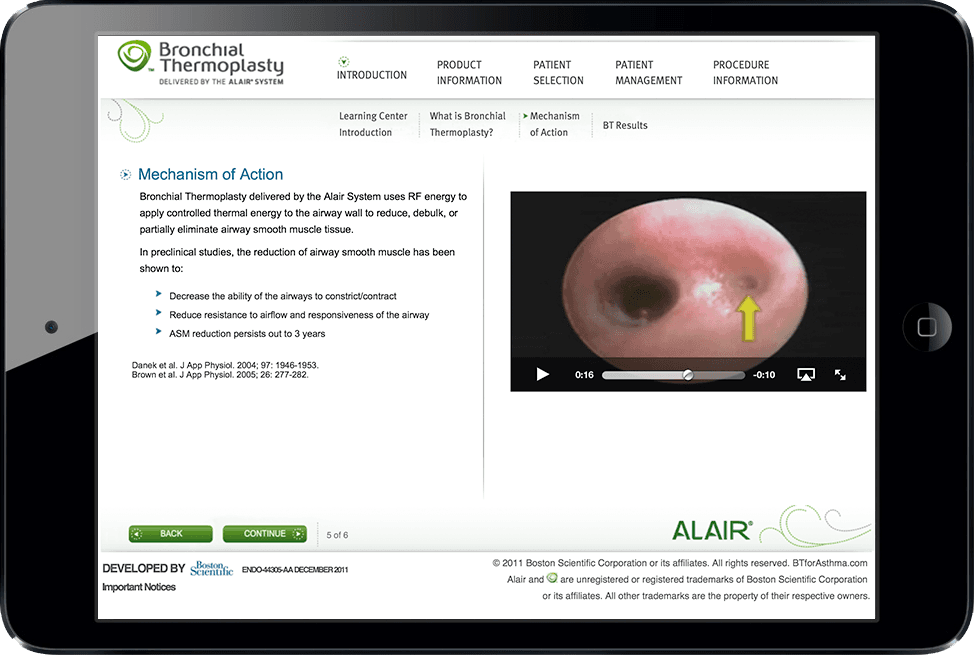 Bronchial Thermoplasty