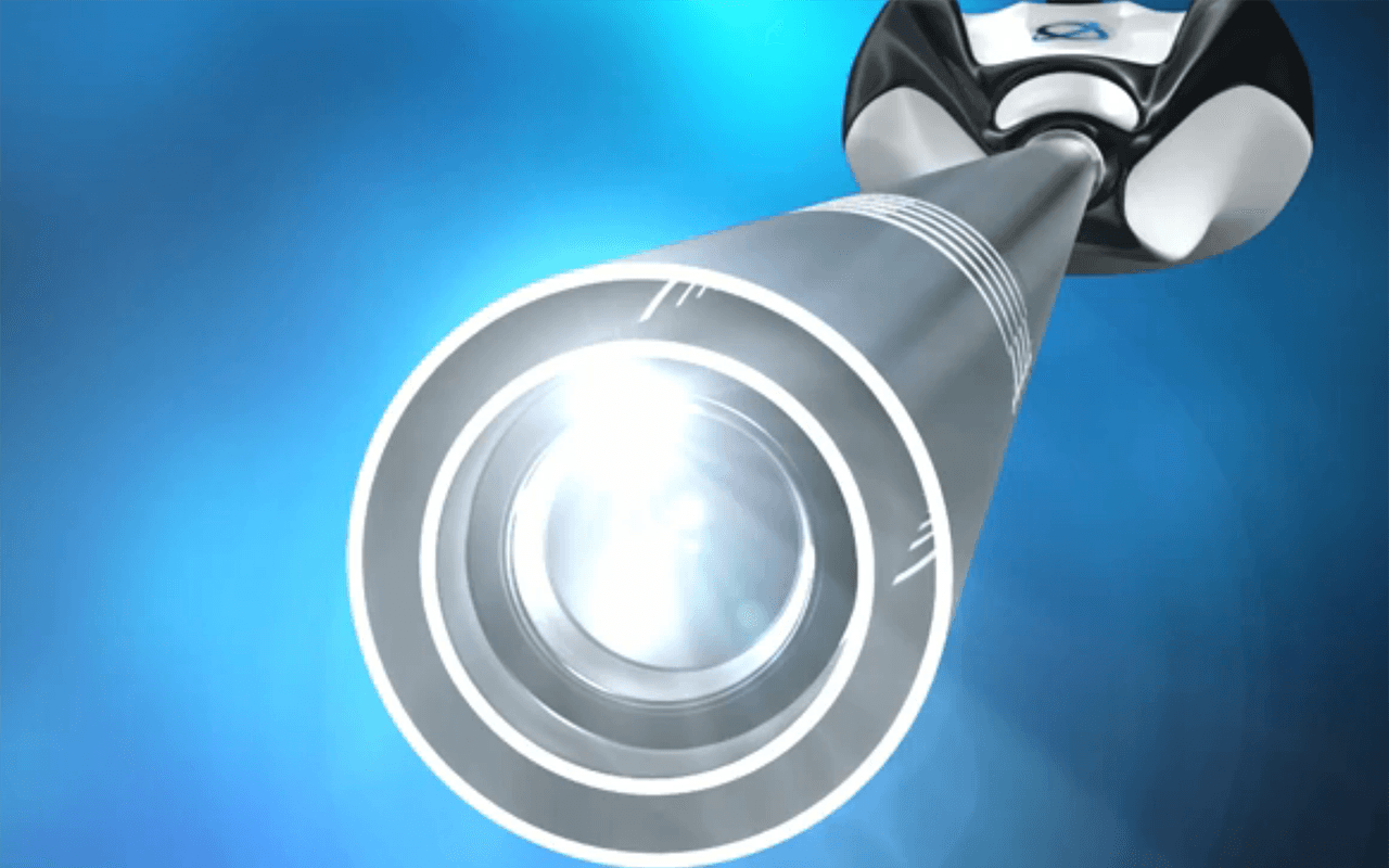 Scope