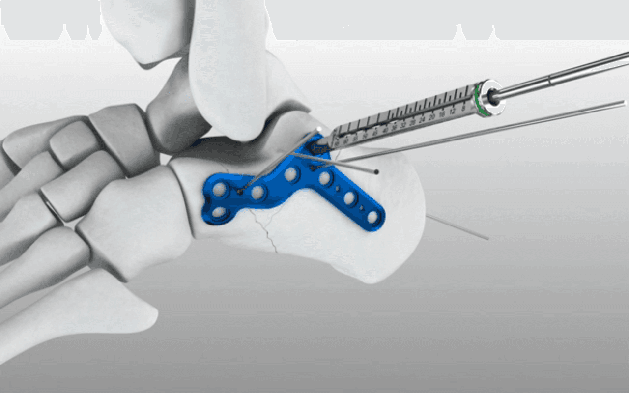 Medical 3D Animation